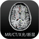7777影院免费观看电视剧小别离中文版
